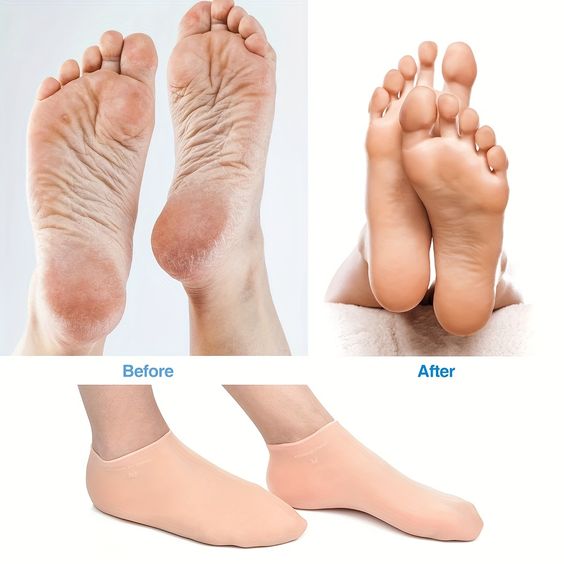 Soft Silicone Moisturizing Socks for Dry, Cracked Feet